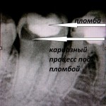 IMG_0788 IMG_0788