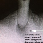 IMG_0790 IMG_0790